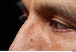 HD Face Skin Moises Molina eye nose skin pores skin…